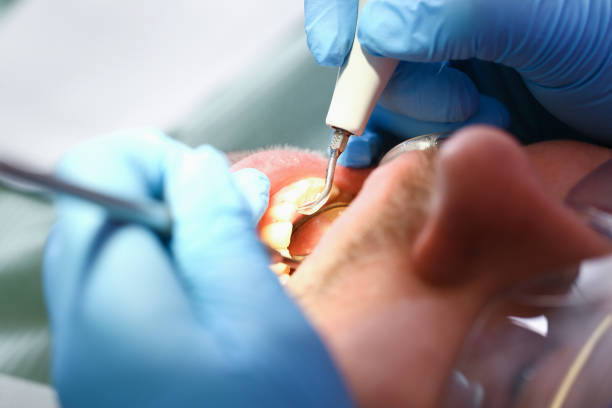 Best Emergency Dentist for Special Needs Patients in East Griffin, GA